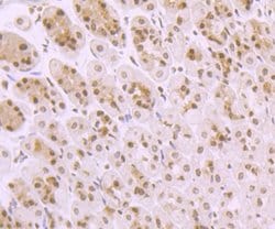 Invitrogen TAK1 Recombinant Rabbit Monoclonal Antibody (JM73-19) 100 &mu;L;