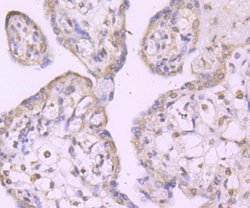 Invitrogen TAK1 Recombinant Rabbit Monoclonal Antibody (JM73-19) 100 &mu;L;