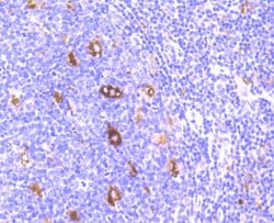 Invitrogen SERPINA3 Recombinant Rabbit Monoclonal Antibody (JM83-29) 100