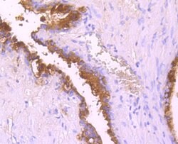 Invitrogen SERPINA3 Recombinant Rabbit Monoclonal Antibody (JM83-29) 100
