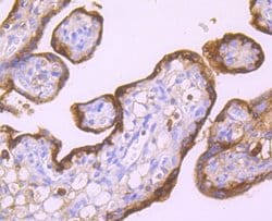 Invitrogen SERPINA3 Recombinant Rabbit Monoclonal Antibody (JM83-29) 100
