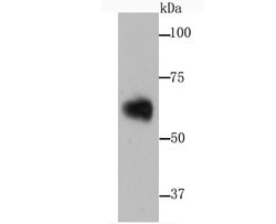 Invitrogen SERPINA3 Recombinant Rabbit Monoclonal Antibody (JM83-29) 100