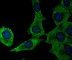 Invitrogen Ferritin Heavy Chain Recombinant Rabbit Monoclonal Antibody