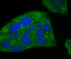 Invitrogen Ferritin Heavy Chain Recombinant Rabbit Monoclonal Antibody