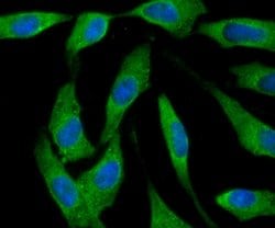 Invitrogen Ferritin Heavy Chain Recombinant Rabbit Monoclonal Antibody