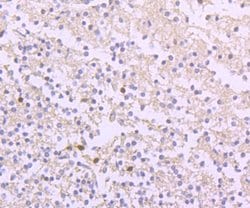Invitrogen Ferritin Heavy Chain Recombinant Rabbit Monoclonal Antibody