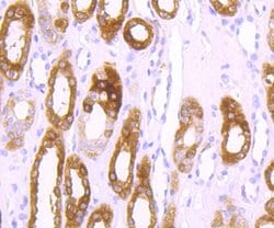 Invitrogen Ferritin Heavy Chain Recombinant Rabbit Monoclonal Antibody