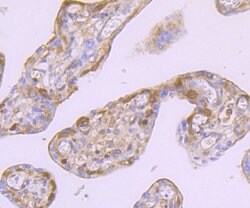 Invitrogen Ferritin Heavy Chain Recombinant Rabbit Monoclonal Antibody