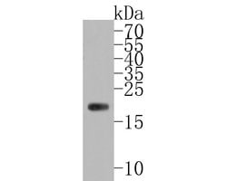Invitrogen Ferritin Heavy Chain Recombinant Rabbit Monoclonal Antibody