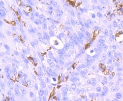 Invitrogen IBA1 Recombinant Rabbit Monoclonal Antibody (JM36-62) 100 &mu;L;