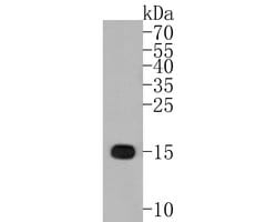 Invitrogen IBA1 Recombinant Rabbit Monoclonal Antibody (JM36-62) 100 &mu;L;