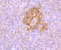 Invitrogen Aldolase A Recombinant Rabbit Monoclonal Antibody (JM54-19)