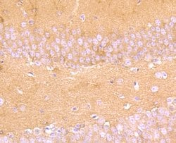 Invitrogen Aldolase A Recombinant Rabbit Monoclonal Antibody (JM54-19)