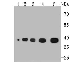 Invitrogen Aldolase A Recombinant Rabbit Monoclonal Antibody (JM54-19)