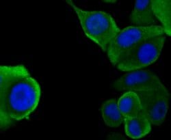 Invitrogen N-WASP Recombinant Rabbit Monoclonal Antibody (JU07-31) 100 &mu;L | Buy Online | Invitrogen&trade; | Fisher Scientific