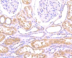 Invitrogen N-WASP Recombinant Rabbit Monoclonal Antibody (JU07-31) 100 &mu;L | Buy Online | Invitrogen&trade; | Fisher Scientific