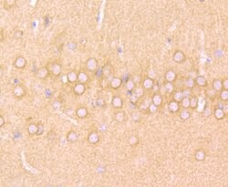 Invitrogen N-WASP Recombinant Rabbit Monoclonal Antibody (JU07-31) 100 &mu;L | Buy Online | Invitrogen&trade; | Fisher Scientific