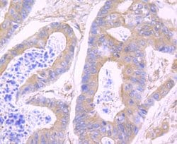 Invitrogen N-WASP Recombinant Rabbit Monoclonal Antibody (JU07-31) 100 &mu;L | Buy Online | Invitrogen&trade; | Fisher Scientific