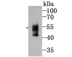 Invitrogen N-WASP Recombinant Rabbit Monoclonal Antibody (JU07-31) 100 &mu;L | Buy Online | Invitrogen&trade; | Fisher Scientific