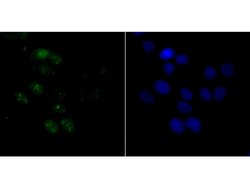 Invitrogen BAF53A Recombinant Rabbit Monoclonal Antibody (JU40-32) 100
