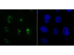 Invitrogen BAF53A Recombinant Rabbit Monoclonal Antibody (JU40-32) 100
