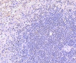 Invitrogen BAF53A Recombinant Rabbit Monoclonal Antibody (JU40-32) 100