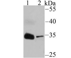 Invitrogen IGFBP2 Recombinant Rabbit Monoclonal Antibody (JU37-46) 100