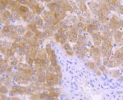 Invitrogen ALDH1L1 Recombinant Rabbit Monoclonal Antibody (JU53-54) 100