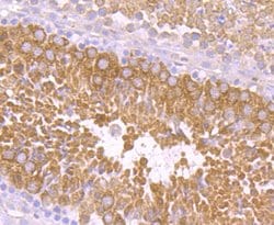 Invitrogen PIWIL1 Recombinant Rabbit Monoclonal Antibody (JU35-12) 100 &mu;L | Buy Online | Invitrogen&trade; | Fisher Scientific