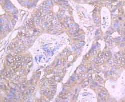Invitrogen GIT1 Recombinant Rabbit Monoclonal Antibody (JU33-39) 100 &mu;L;