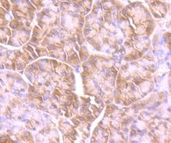 Invitrogen GIT1 Recombinant Rabbit Monoclonal Antibody (JU33-39) 100 &mu;L;