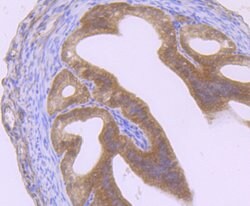 Invitrogen GIT1 Recombinant Rabbit Monoclonal Antibody (JU33-39) 100 &mu;L;