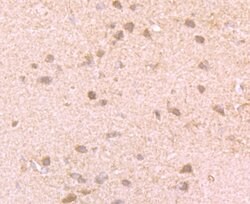 Invitrogen GIT1 Recombinant Rabbit Monoclonal Antibody (JU33-39) 100 &mu;L;