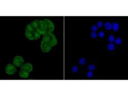 CRM1 Recombinant Rabbit Monoclonal Antibody (JB35-22):Antibodies, Recombinant