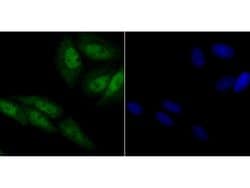 CRM1 Recombinant Rabbit Monoclonal Antibody (JB35-22):Antibodies, Recombinant
