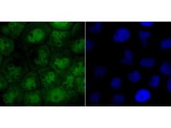 CRM1 Recombinant Rabbit Monoclonal Antibody (JB35-22):Antibodies, Recombinant