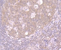 CRM1 Recombinant Rabbit Monoclonal Antibody (JB35-22):Antibodies, Recombinant