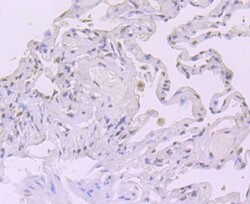 CRM1 Recombinant Rabbit Monoclonal Antibody (JB35-22):Antibodies, Recombinant