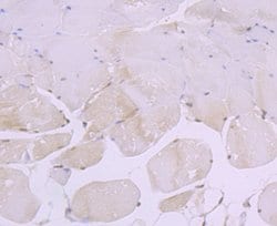 CRM1 Recombinant Rabbit Monoclonal Antibody (JB35-22):Antibodies, Recombinant