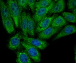 Invitrogen PCK2 Recombinant Rabbit Monoclonal Antibody (JB52-39) 100 &mu;L;