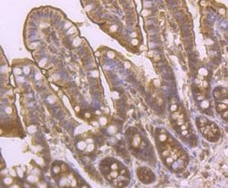 Invitrogen PCK2 Recombinant Rabbit Monoclonal Antibody (JB52-39) 100 &mu;L;