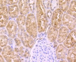 Invitrogen PCK2 Recombinant Rabbit Monoclonal Antibody (JB52-39) 100 &mu;L;