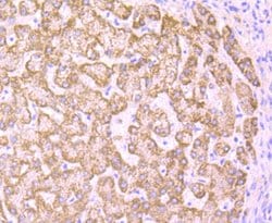 Invitrogen PCK2 Recombinant Rabbit Monoclonal Antibody (JB52-39) 100 &mu;L;