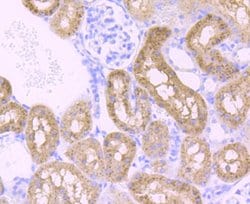 Invitrogen PCK2 Recombinant Rabbit Monoclonal Antibody (JB52-39) 100 &mu;L;