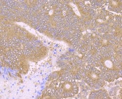 Invitrogen PCK2 Recombinant Rabbit Monoclonal Antibody (JB52-39) 100 &mu;L;