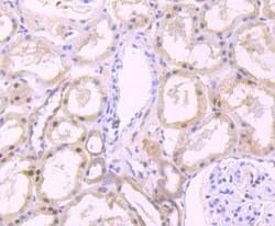 Invitrogen FKBP5 Recombinant Rabbit Monoclonal Antibody (JB95-39) 100 &mu;L;