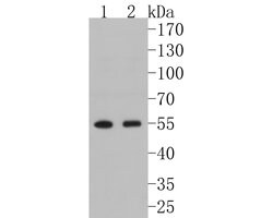 Invitrogen FKBP5 Recombinant Rabbit Monoclonal Antibody (JB95-39) 100 &mu;L;
