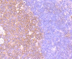 Invitrogen&trade;&nbsp;CXCR5 Recombinant Rabbit Monoclonal Antibody (JB11-40)