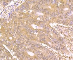 Invitrogen PAK2 Recombinant Rabbit Monoclonal Antibody (JB41-84) 100 &mu;L;