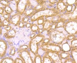Invitrogen PAK2 Recombinant Rabbit Monoclonal Antibody (JB41-84) 100 &mu;L;